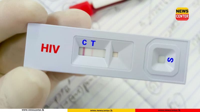 Specialist warns HIV cases on the rise in Sri Lanka